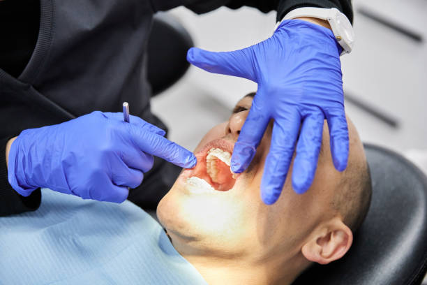 Best Emergency Dentist for Lost Fillings or Crowns in Heritage Village, CT