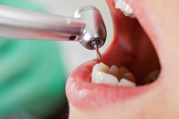 Best Pediatric Emergency Dentist in Heritage Village, CT